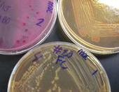 MacConkey's Media growing E. coli, Enterobacter & Salmonella (clockwise from left top)