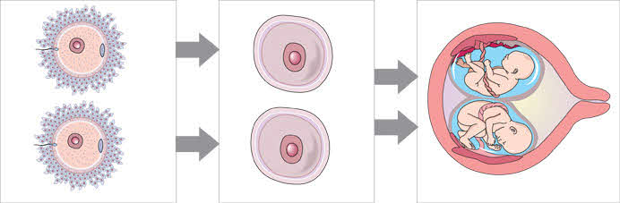 Fraternal  twin development