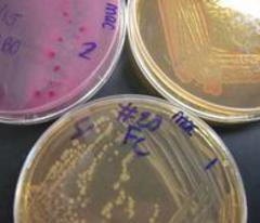 MacConkey's Agar growing E. coli, Enterobacter & Salmonella  (clockwise from top left plate).